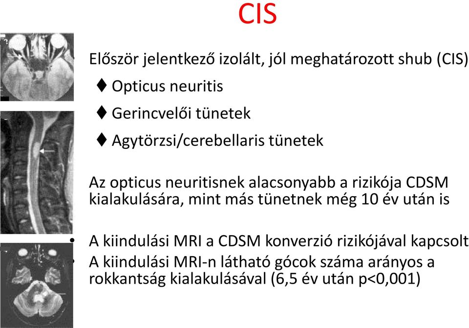 kialakulására, mint más tünetnek még 10 év után is A kiindulási MRI a CDSM konverzió