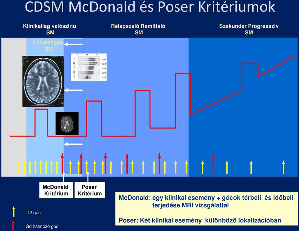 halmozó góc Poser Kritérium McDonald: egy klinikai esemény + gócok térbeli és