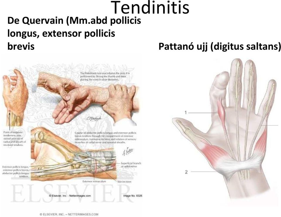 extensor pollicis brevis