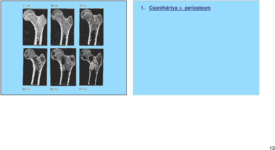 Csontvel = medulla ossium Vörös csontvel : rövid, lapos,