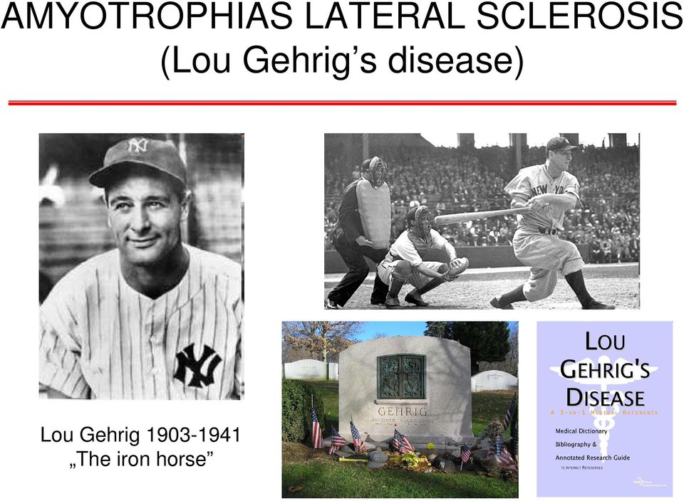 s disease) Lou Gehrig