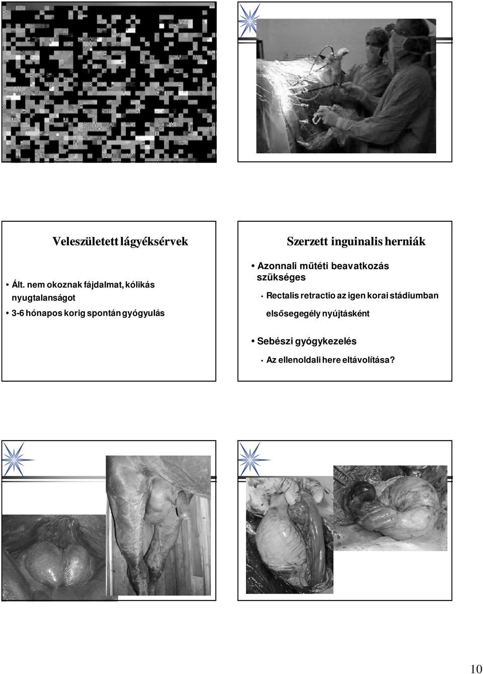 gyógyulás Szerzett inguinalis herniák Azonnali műtéti beavatkozás szükséges
