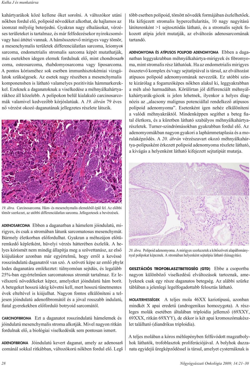 A hám össze tevô mirigyes vagy tömör, a mesenchymalis területek differenciálatlan sarcoma, leiomyo sarcoma, endometrialis stromalis sarcoma képét mutathatják, más esetekben idegen elemek fordulnak
