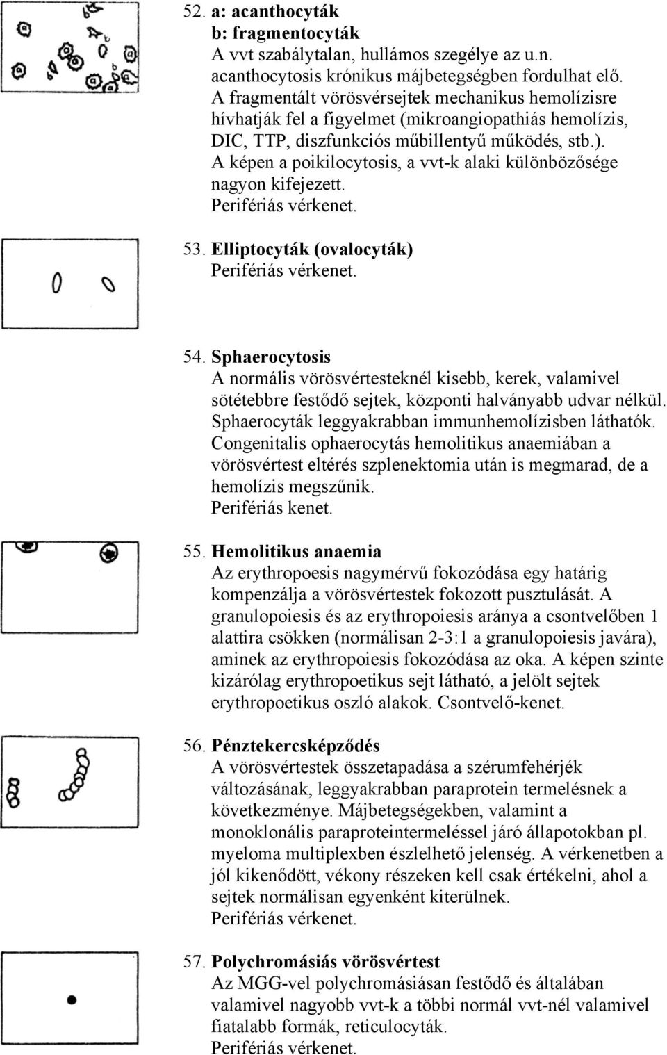 A képen a poikilocytosis, a vvt-k alaki különbözősége nagyon kifejezett. 53. Elliptocyták (ovalocyták) 54.