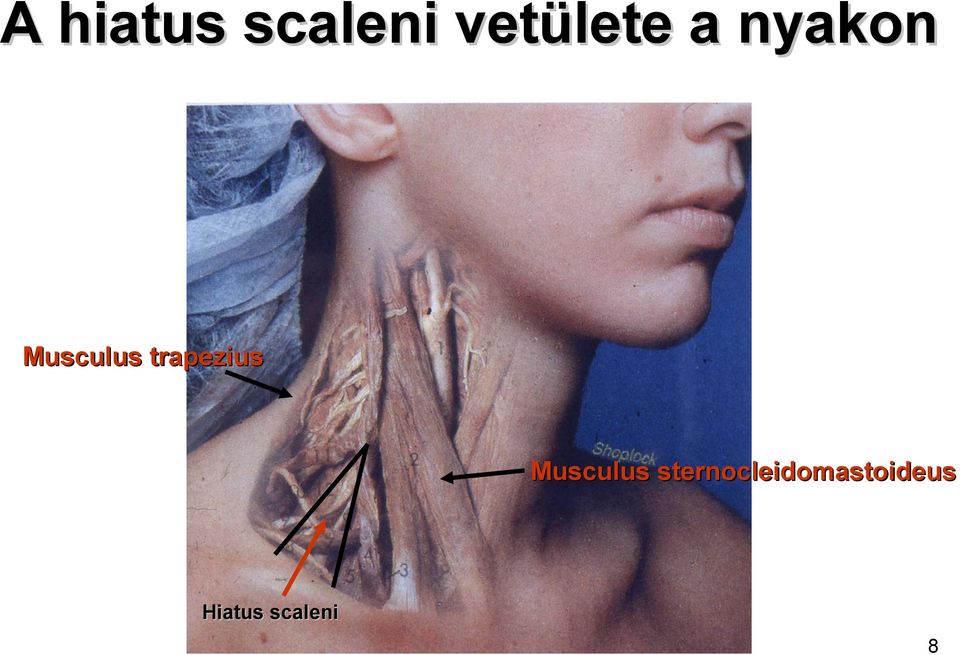 trapezius Musculus