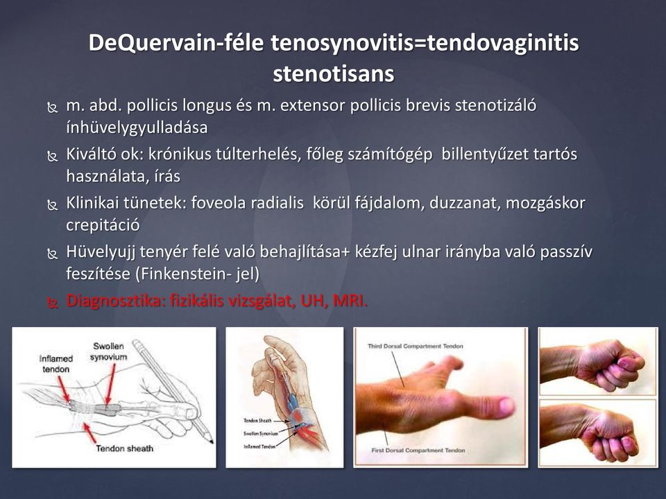 billentyűzet tartós használata, írás Klinikai tünetek: foveola radialis körül fájdalom, duzzanat, mozgáskor