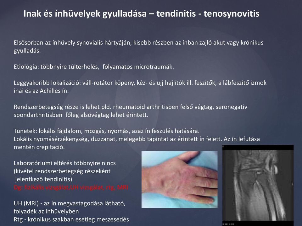 Rendszerbetegség része is lehet pld. rheumatoid arthritisben felső végtag, seronegativ spondarthritisben főleg alsóvégtag lehet érintett.