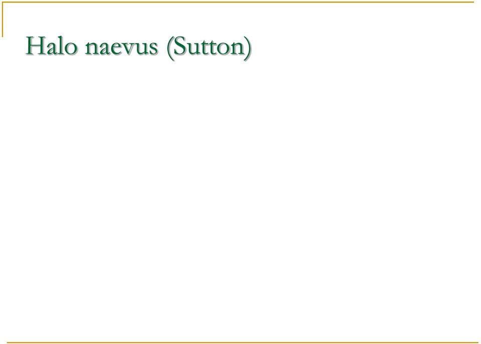 (Sutton)