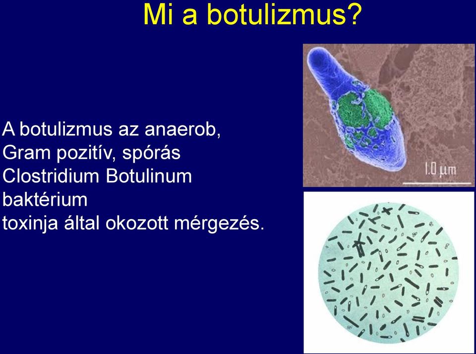 pozitív, spórás Clostridium