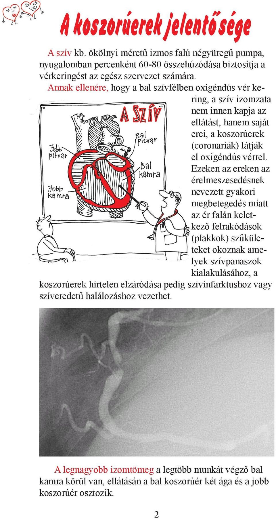 Ezeken az ereken az érelmeszesedésnek nevezett gyakori megbetegedés miatt az ér falán keletkező felrakódások (plakkok) szűkületeket okoznak amelyek szívpanaszok kialakulásához, a koszorúerek