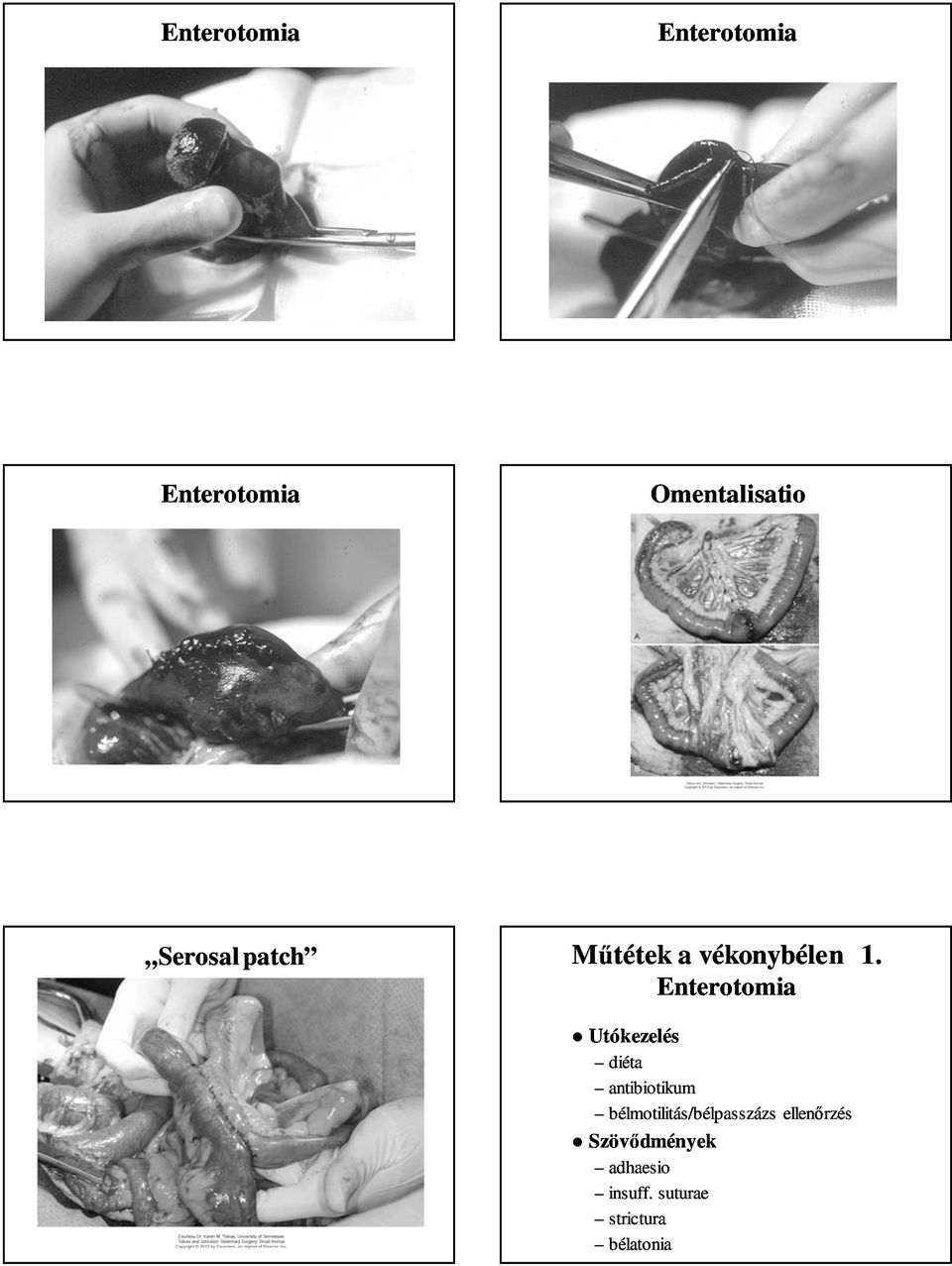 Enterotomia Utókezelés diéta antibiotikum