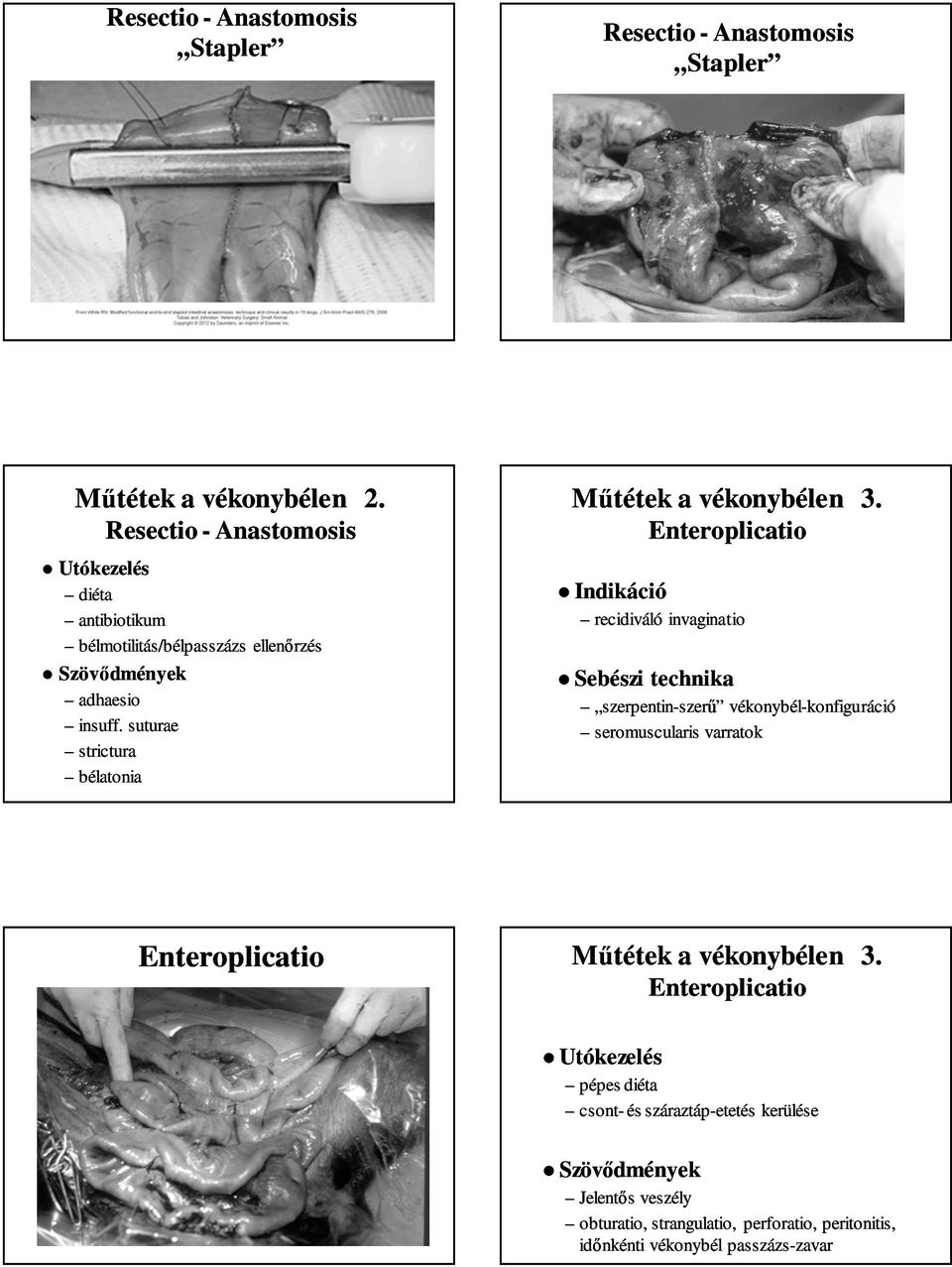 suturae strictura bélatonia Műtétek a vékonybélen 3.