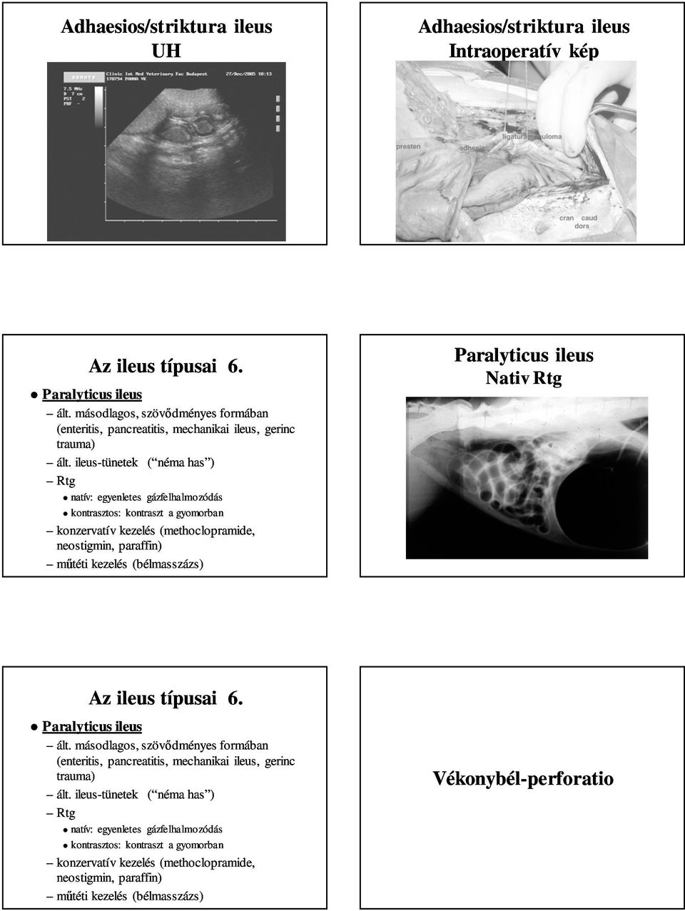 (bélmasszázs) Paralyticus ileus Nativ Rtg Az ileus típusai 6. Paralyticus ileus ált.