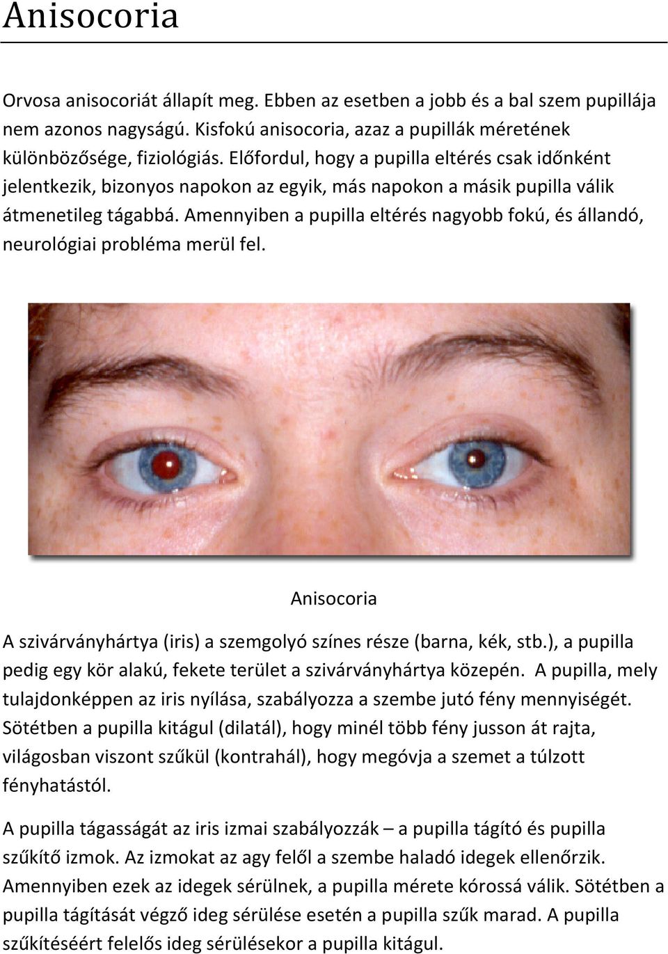 tonsillitis homályos látás glushkova e vigyázni a szemedre