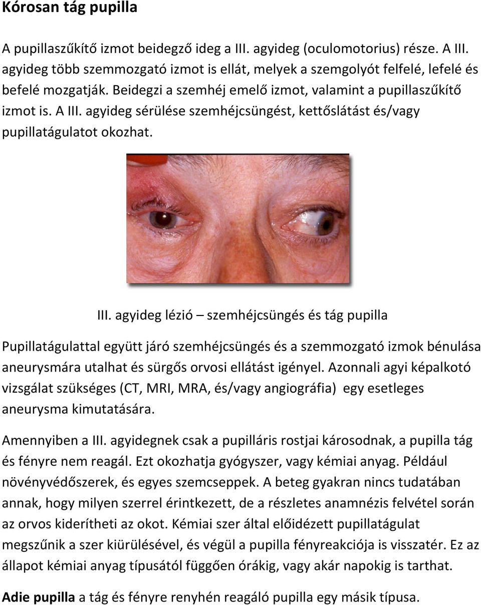 agyideg sérülése szemhéjcsüngést, kettőslátást és/vagy pupillatágulatot okozhat. III.