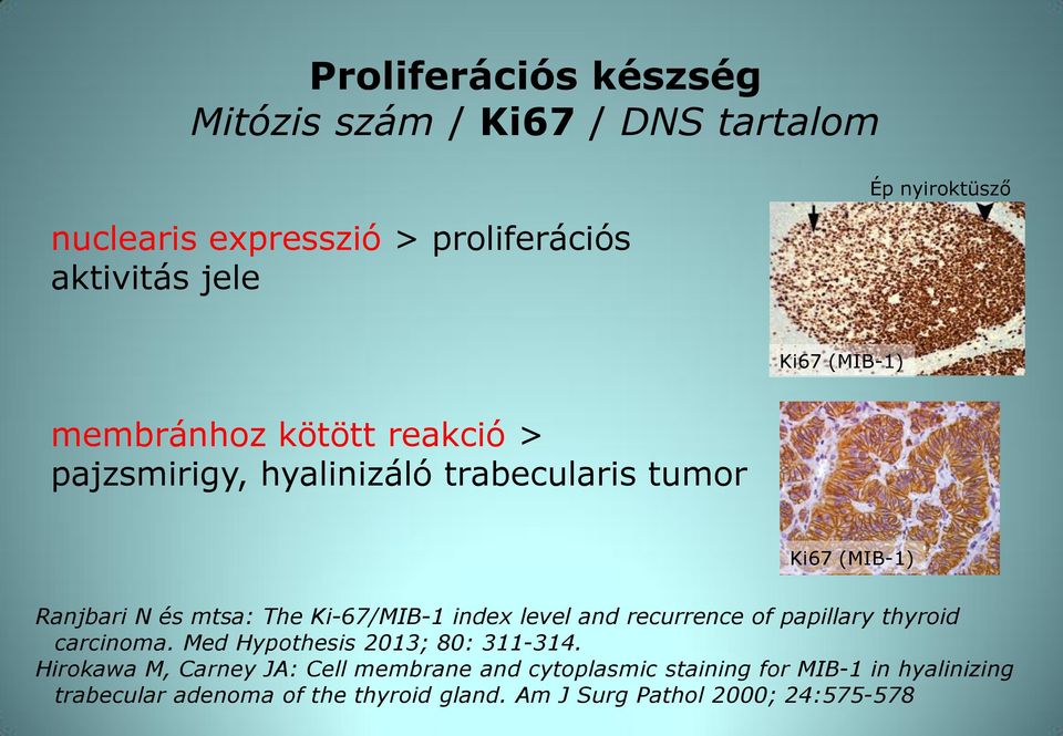 Ki-67/MIB-1 index level and recurrence of papillary thyroid carcinoma. Med Hypothesis 2013; 80: 311-314.