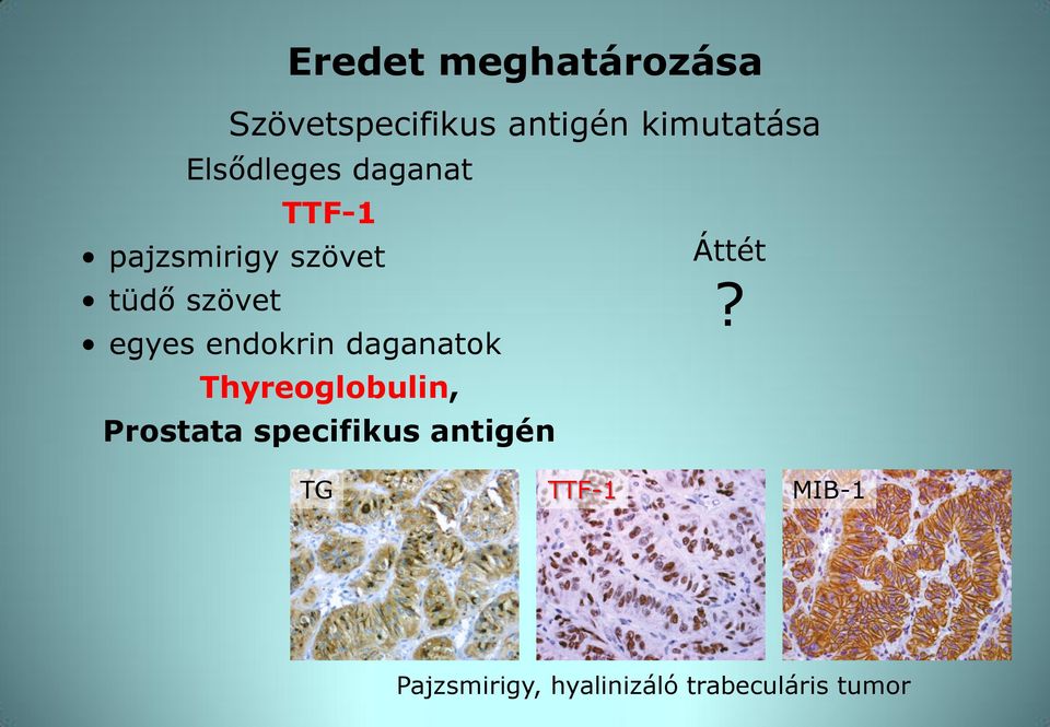 endokrin daganatok Thyreoglobulin, Prostata specifikus