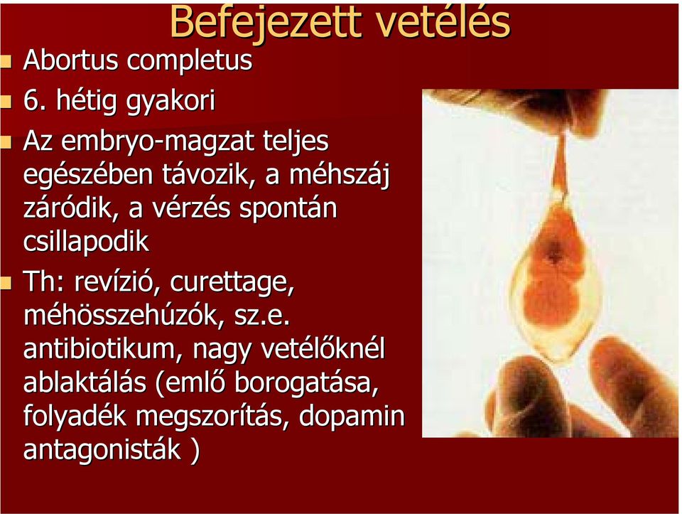 záródik, a vérzés spontán csillapodik Th: : revízió, curettage,