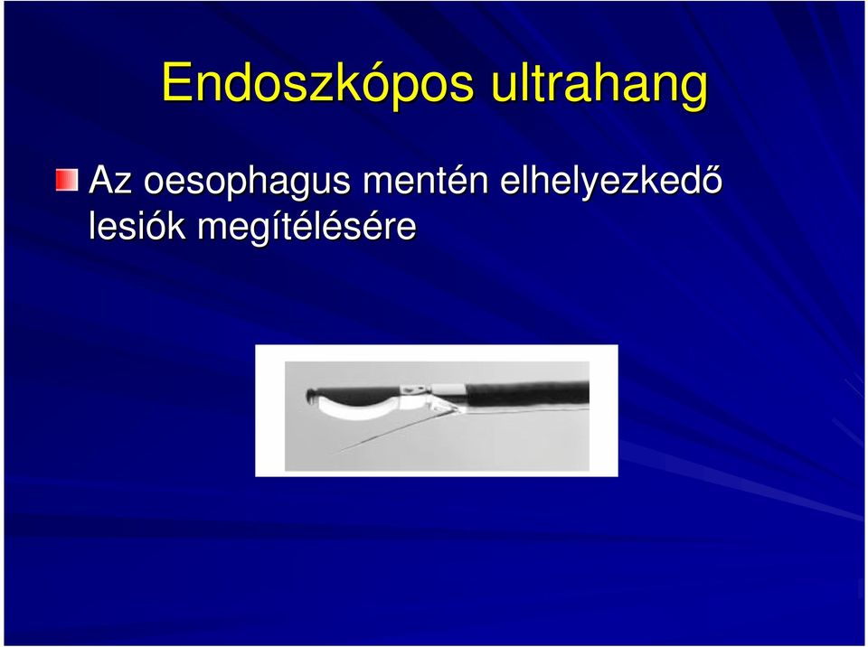 oesophagus mentén n