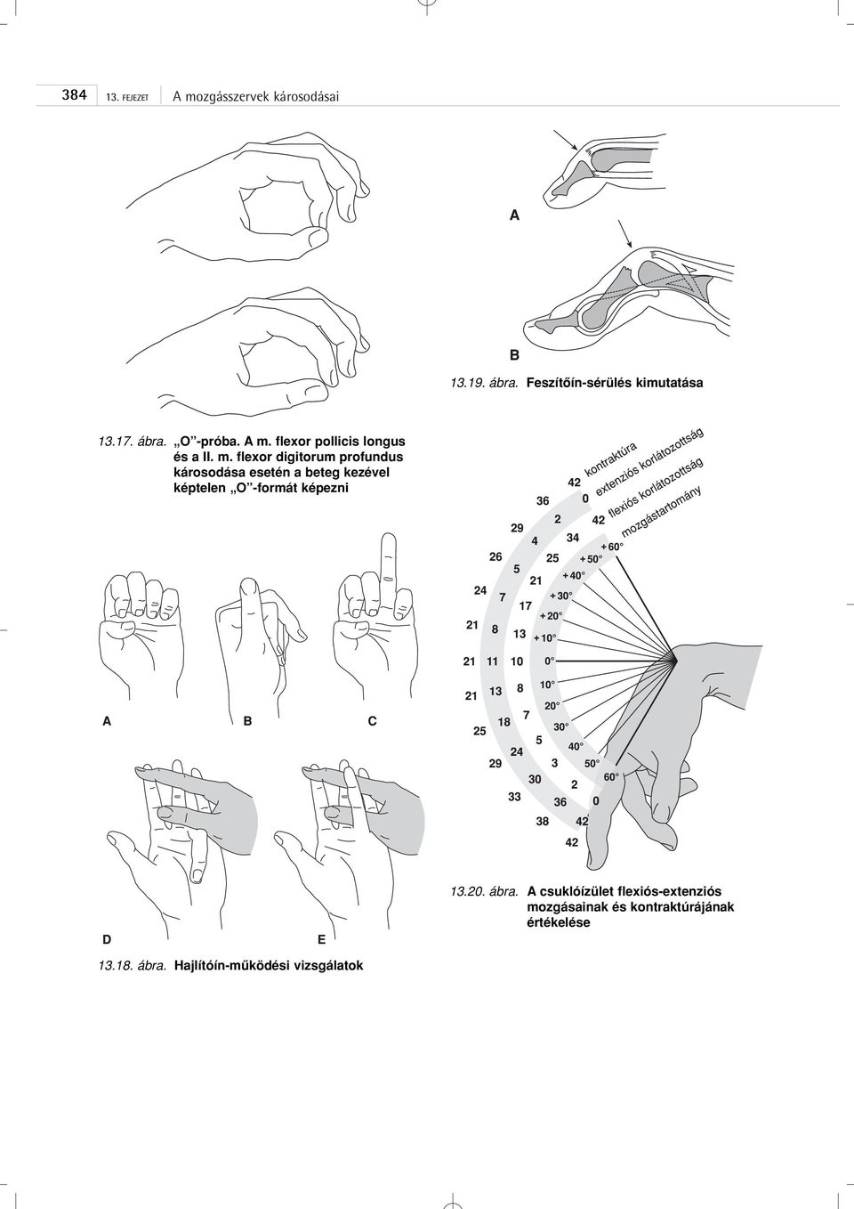 flexor digitorum profundus károsodása esetén a beteg kezével képtelen O -formát