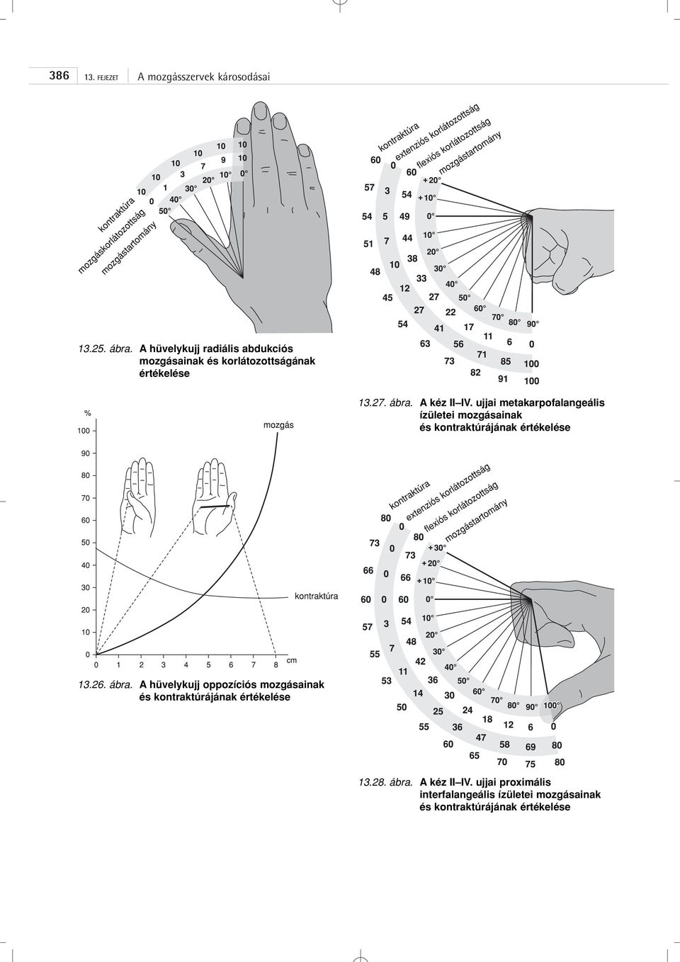 A kéz II IV. ujjai metakarpofalangeális ízületei mozgásainak és kontraktúrájának értékelése 13.26.