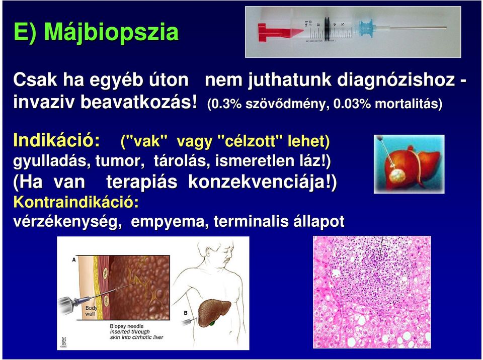 03% mortalitás) Indikáci ció: ("vak" vagy "célzott" lehet) gyulladás, tumor,