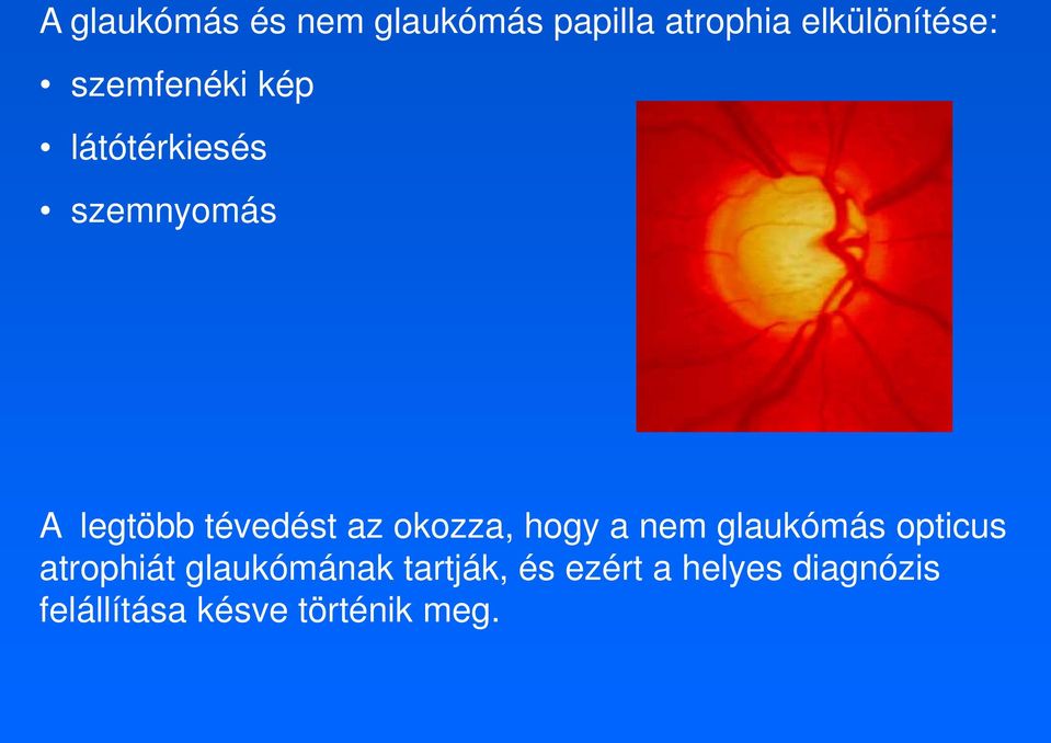 okozza, hogy a nem glaukómás opticus atrophiát glaukómának
