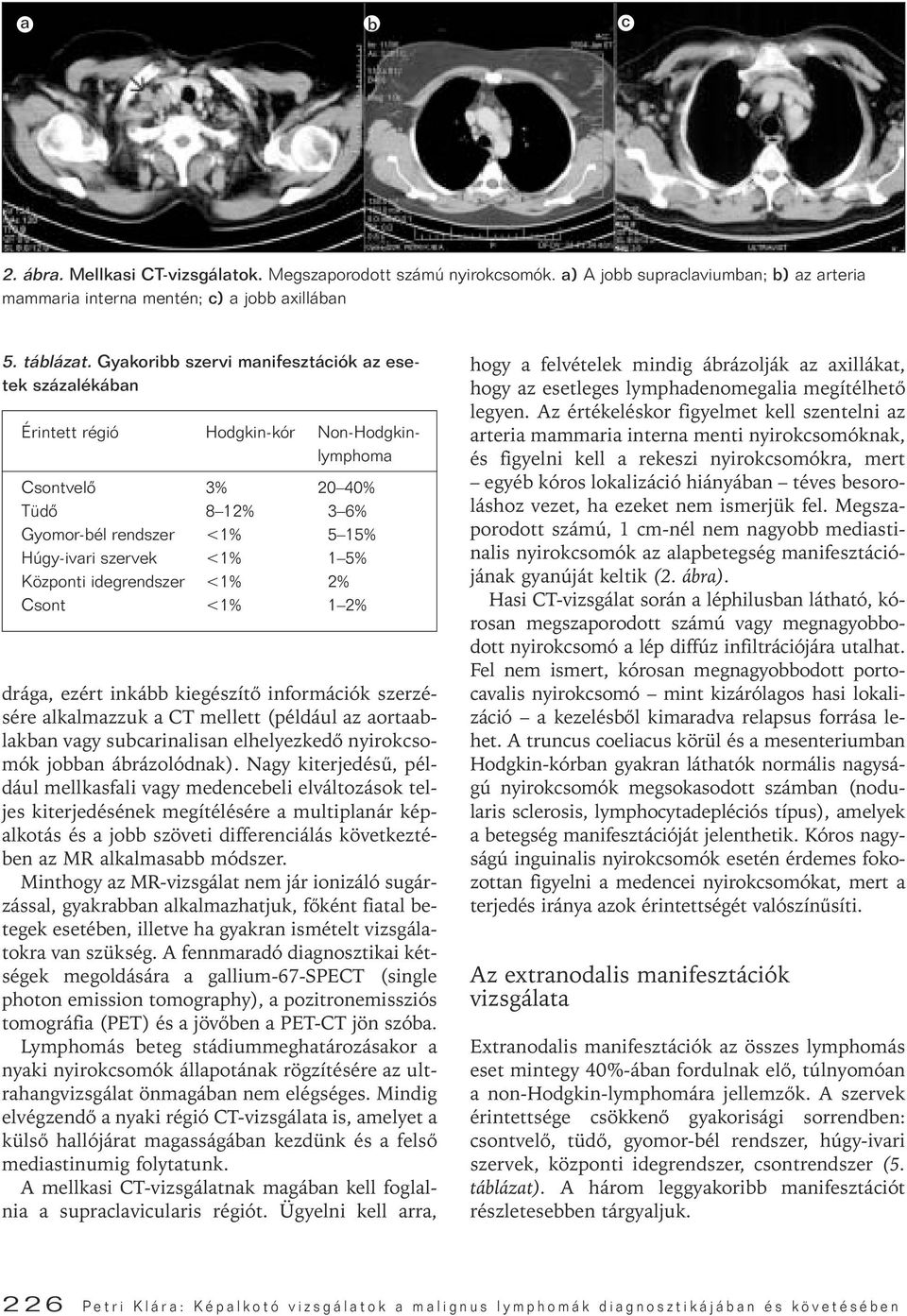 Központi idegrendszer <1% 2% Csont <1% 1 2% drága, ezért inkább kiegészítô információk szerzésére alkalmazzuk a CT mellett (például az aortaablakban vagy subcarinalisan elhelyezkedô nyirokcsomók