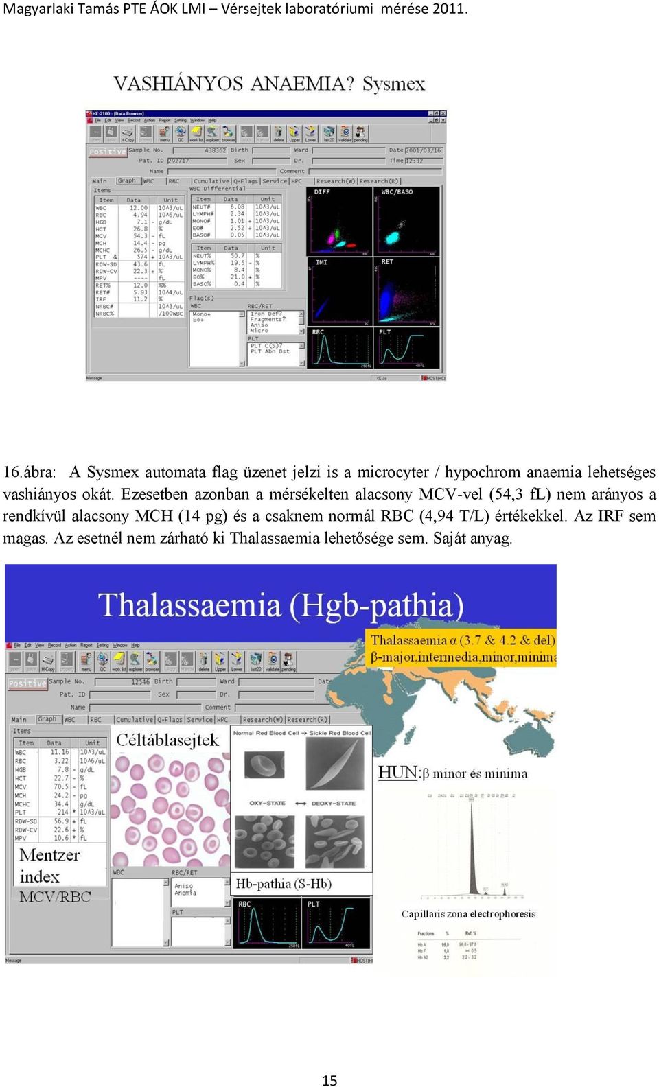 VÉRsejtek laboratóriumi mérése vérkép automaták és a Flow cytometria  klinikai laboratóriumi alkalmazása - PDF Ingyenes letöltés