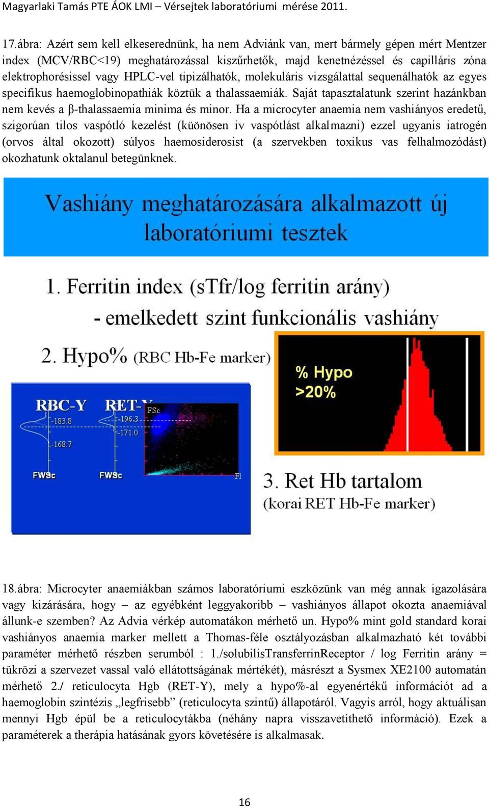 Saját tapasztalatunk szerint hazánkban nem kevés a β-thalassaemia minima és minor.