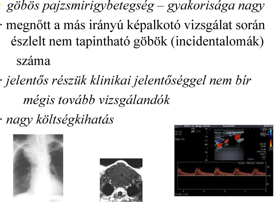 göbök (incidentalomák) száma jelentős részük klinikai