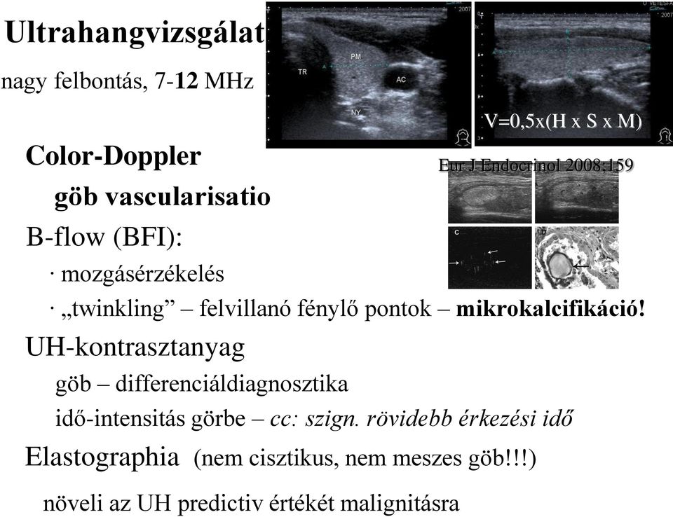 UH-kontrasztanyag V=0,5x(H x S x M) Eur J Endocrinol 2008;159 göb differenciáldiagnosztika