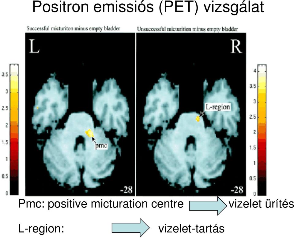 micturation centre vizelet