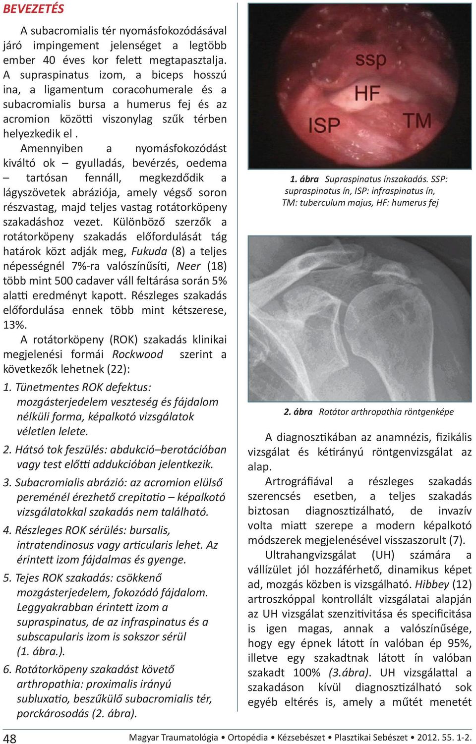 Amennyiben a nyomásfokozódást kiváltó ok gyulladás, bevérzés, oedema tartósan fennáll, megkezdődik a lágyszövetek abráziója, amely végső soron részvastag, majd teljes vastag rotátorköpeny szakadáshoz