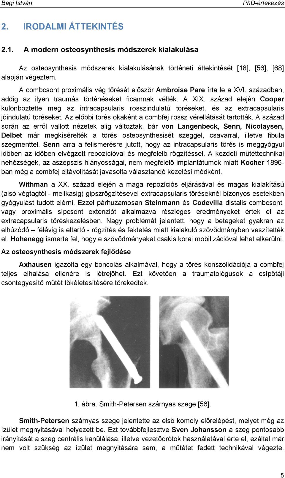 század elején Cooper különböztette meg az intracapsularis rosszindulatú töréseket, és az extracapsularis jóindulatú töréseket. Az előbbi törés okaként a combfej rossz vérellátását tartották.