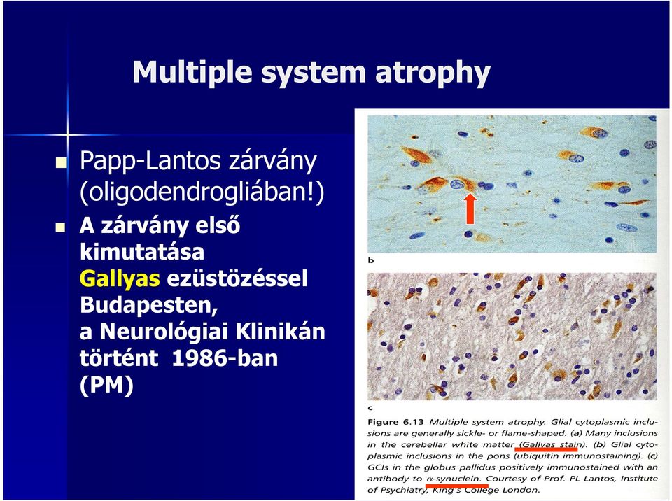 ) A zárvány első kimutatása Gallyas