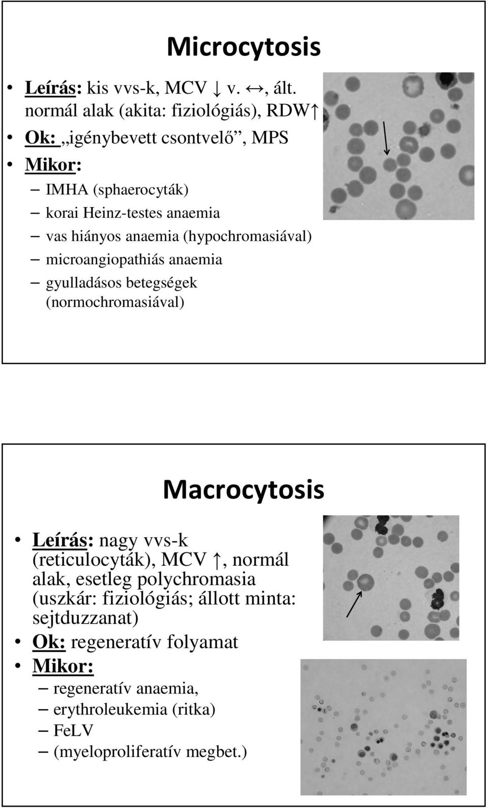 hiányos anaemia (hypochromasiával) microangiopathiás anaemia gyulladásos betegségek (normochromasiával) Macrocytosis Leírás: nagy