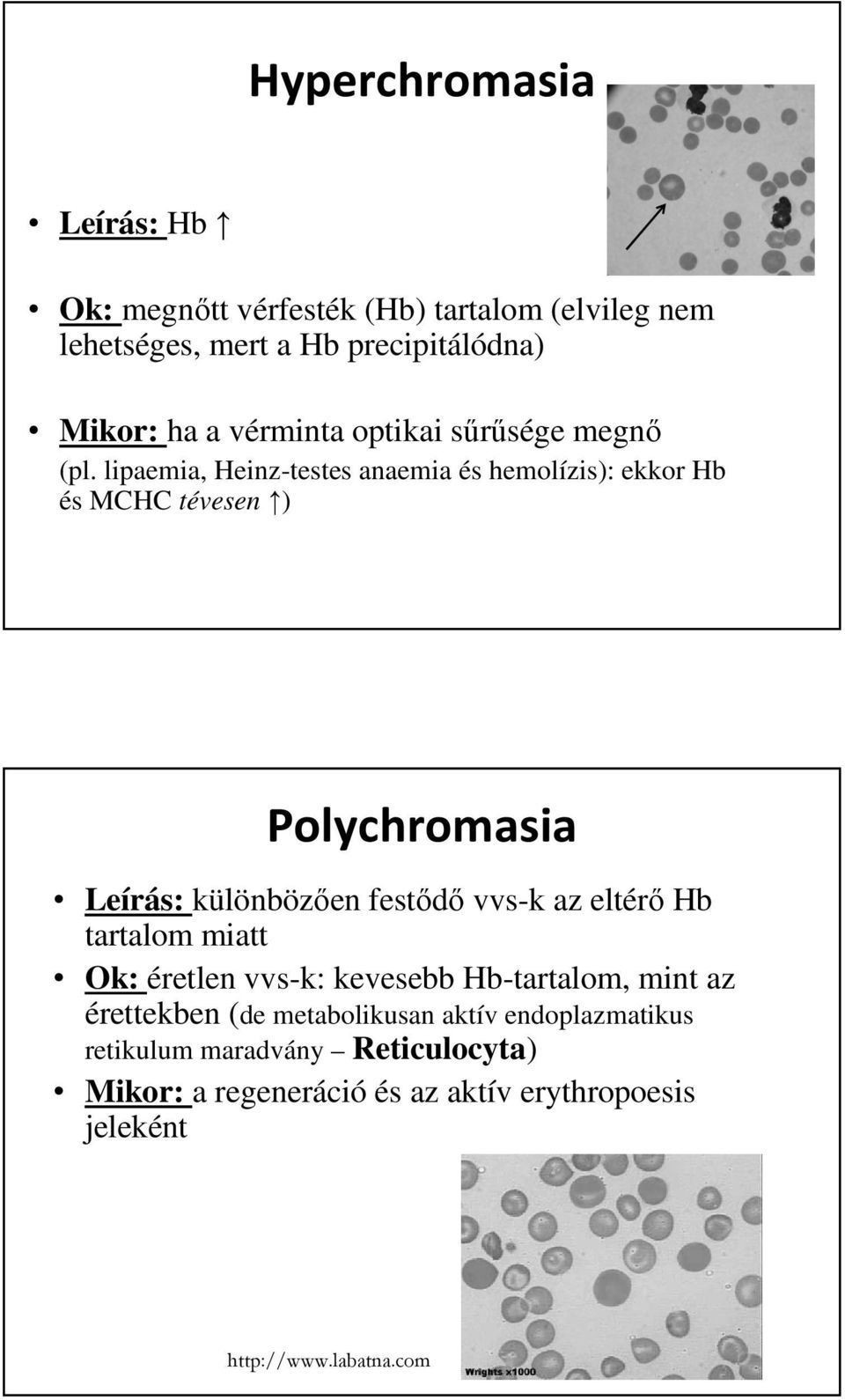lipaemia, Heinz-testes anaemia és hemolízis): ekkor Hb és MCHC tévesen ) Polychromasia Leírás: különbözően festődő vvs-k az eltérő