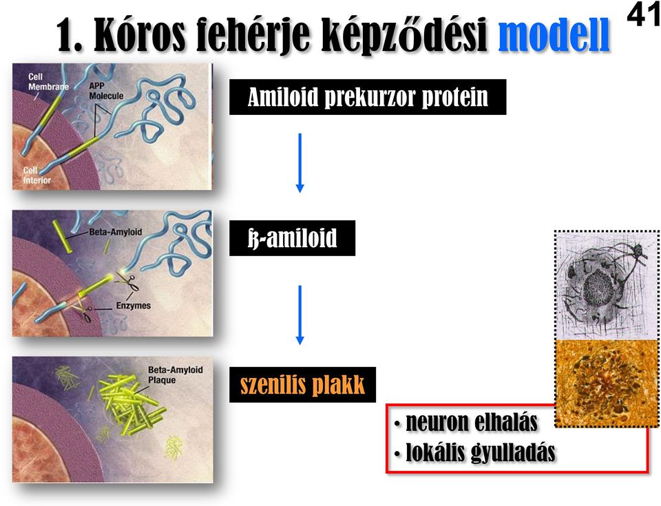 protein ß-amiloid szenilis