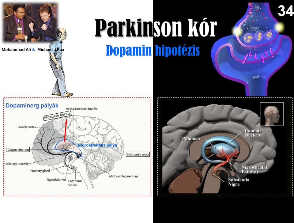 hipotézis 34 Dopaminerg