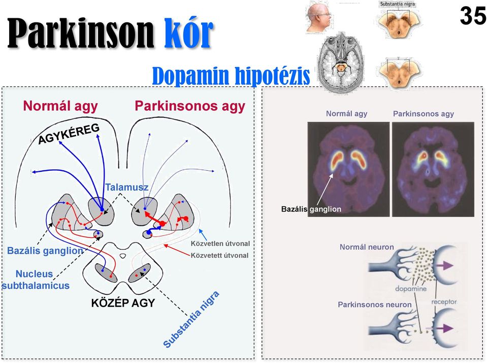 Bazális ganglion Közvetlen útvonal Közvetett útvonal