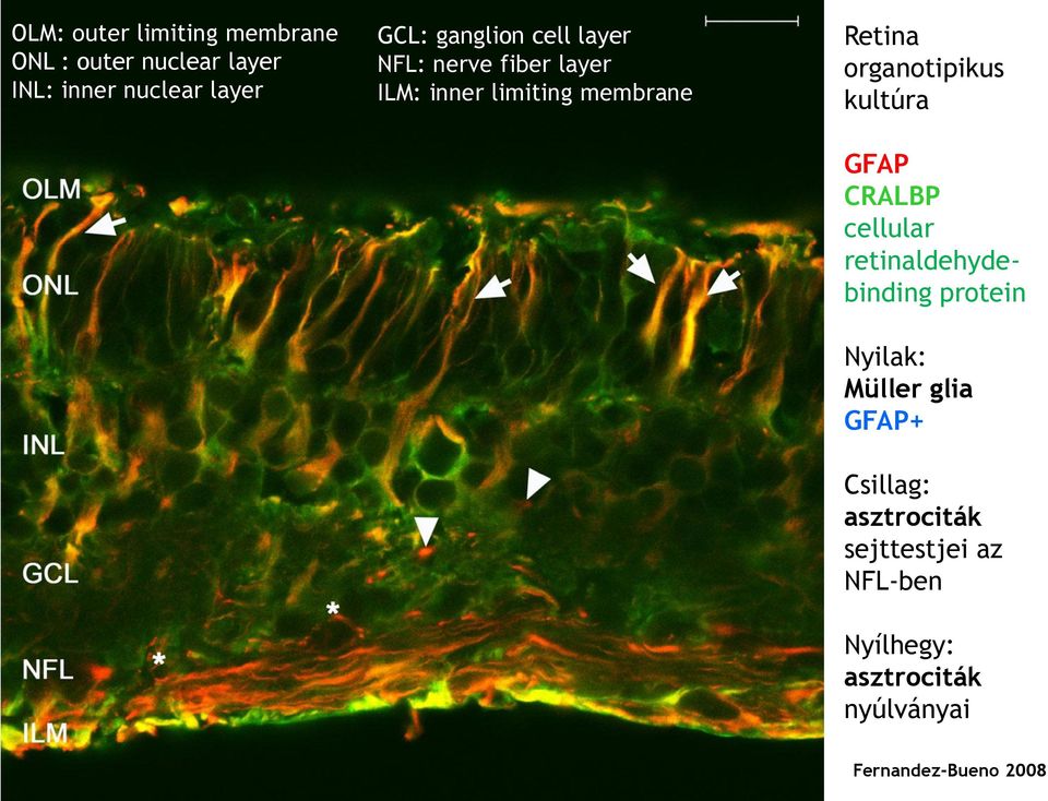 organotipikus kultúra GFAP CRALBP cellular retinaldehydebinding protein Nyilak: Müller