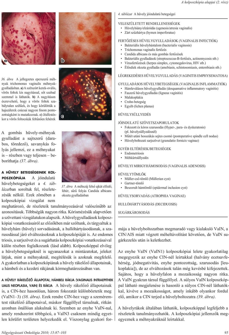 (VAGINALIS INFECTIÓK) Bakteriális hüvelybántalom (bacterialis vaginosis) Trichomonas vaginalis fertôzés Candida albicans és más gombás fertôzések Bakteriális gyulladások (streptococcus-b-fertôzés,