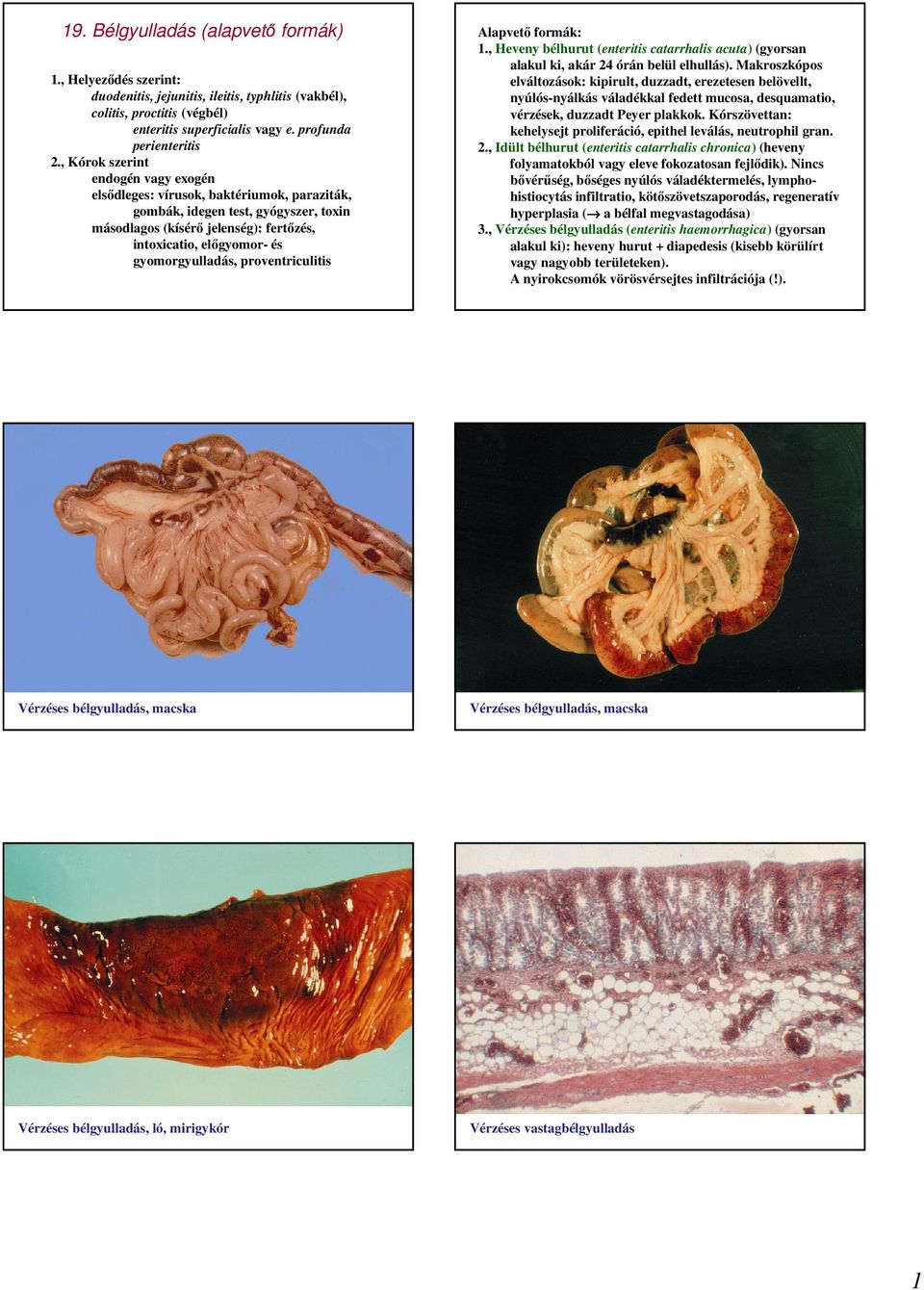 gyomorgyulladás, proventriculitis Alapvetı formák: 1., Heveny bélhurut (enteritis catarrhalis acuta) (gyorsan alakul ki, akár 24 órán belül elhullás).