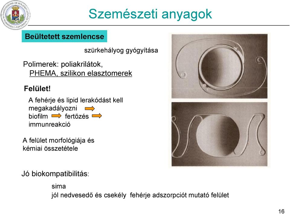 felület morfológiája és kémiai összetétele Szemészeti anyagok szürkehályog gyógyítása