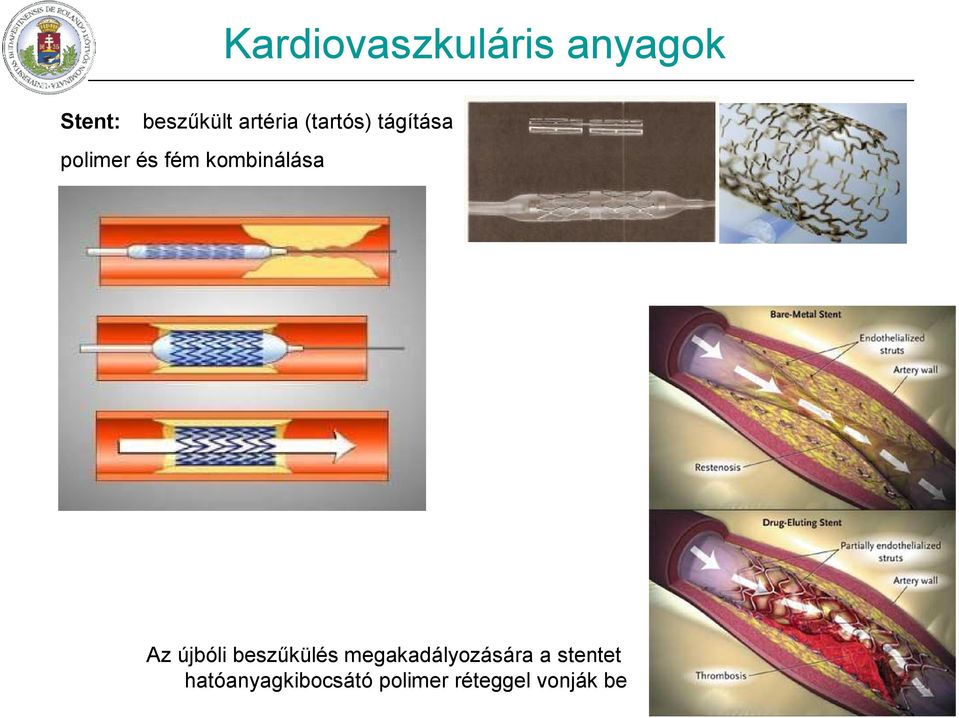 kombinálása Az újbóli beszűkülés