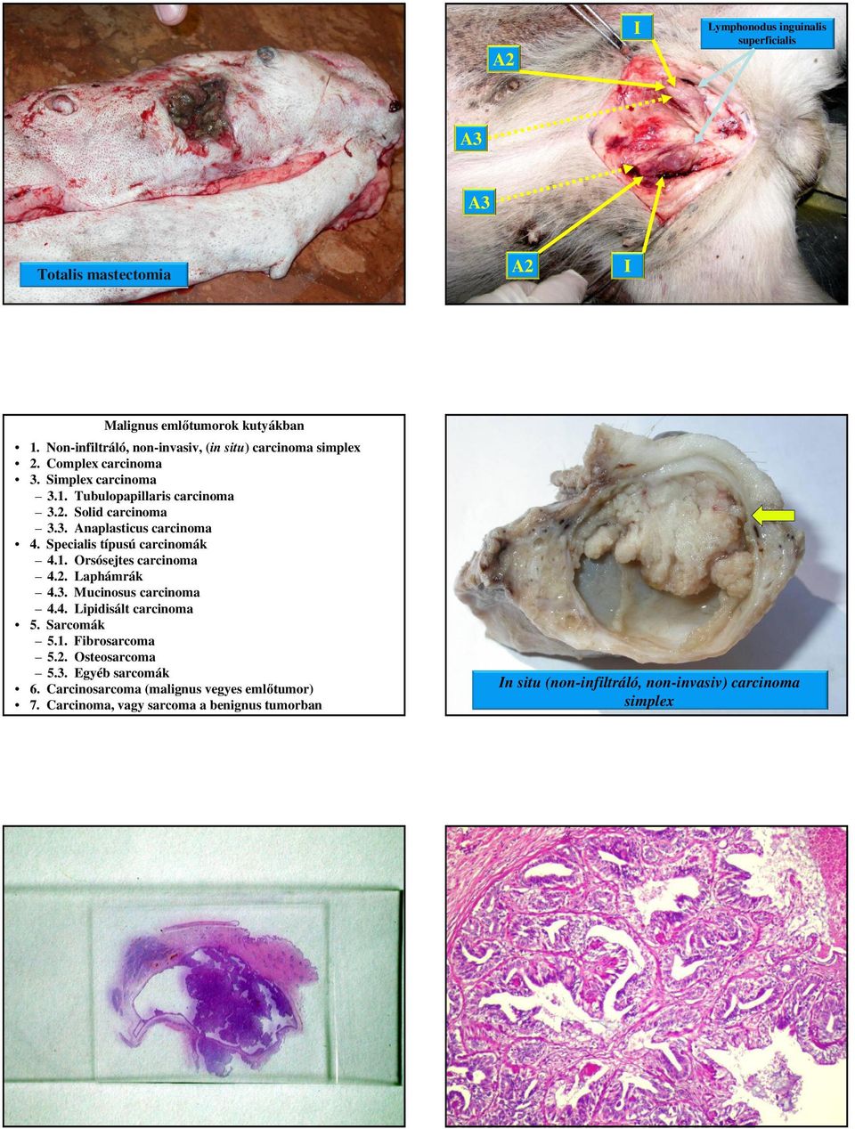 Specialis típusú carcinomák 4.1. Orsósejtes carcinoma 4.2. Laphámrák 4.3. Mucinosus carcinoma 4.4. Lipidisált carcinoma 5. Sarcomák 5.1. Fibrosarcoma 5.2. Osteosarcoma 5.