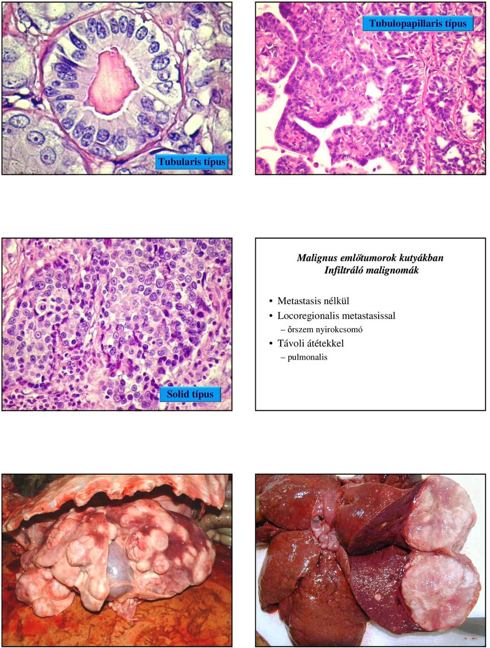 Metastasis nélkül Locoregionalis metastasissal