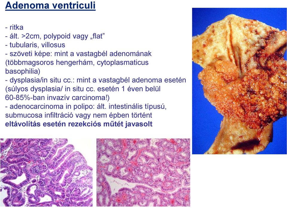 hengerhám, cytoplasmaticus basophilia) - dysplasia/in situ cc.