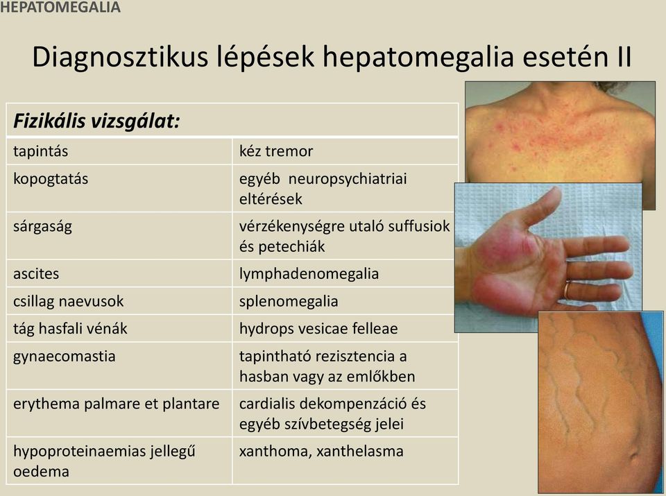 egyéb neuropsychiatriai eltérések vérzékenységre utaló suffusiok és petechiák lymphadenomegalia splenomegalia hydrops